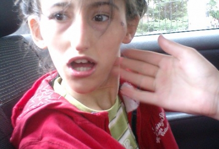 Büşra'nın Kulak Cihazını Teslim Ettik